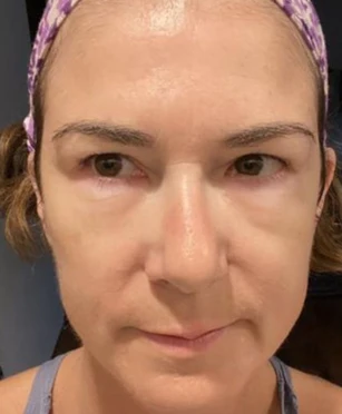 Depoimento de Ana Paula